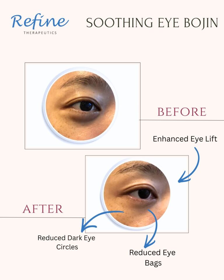 Soothing Eye Bojin